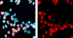 Gen E1a de adenovirus.
