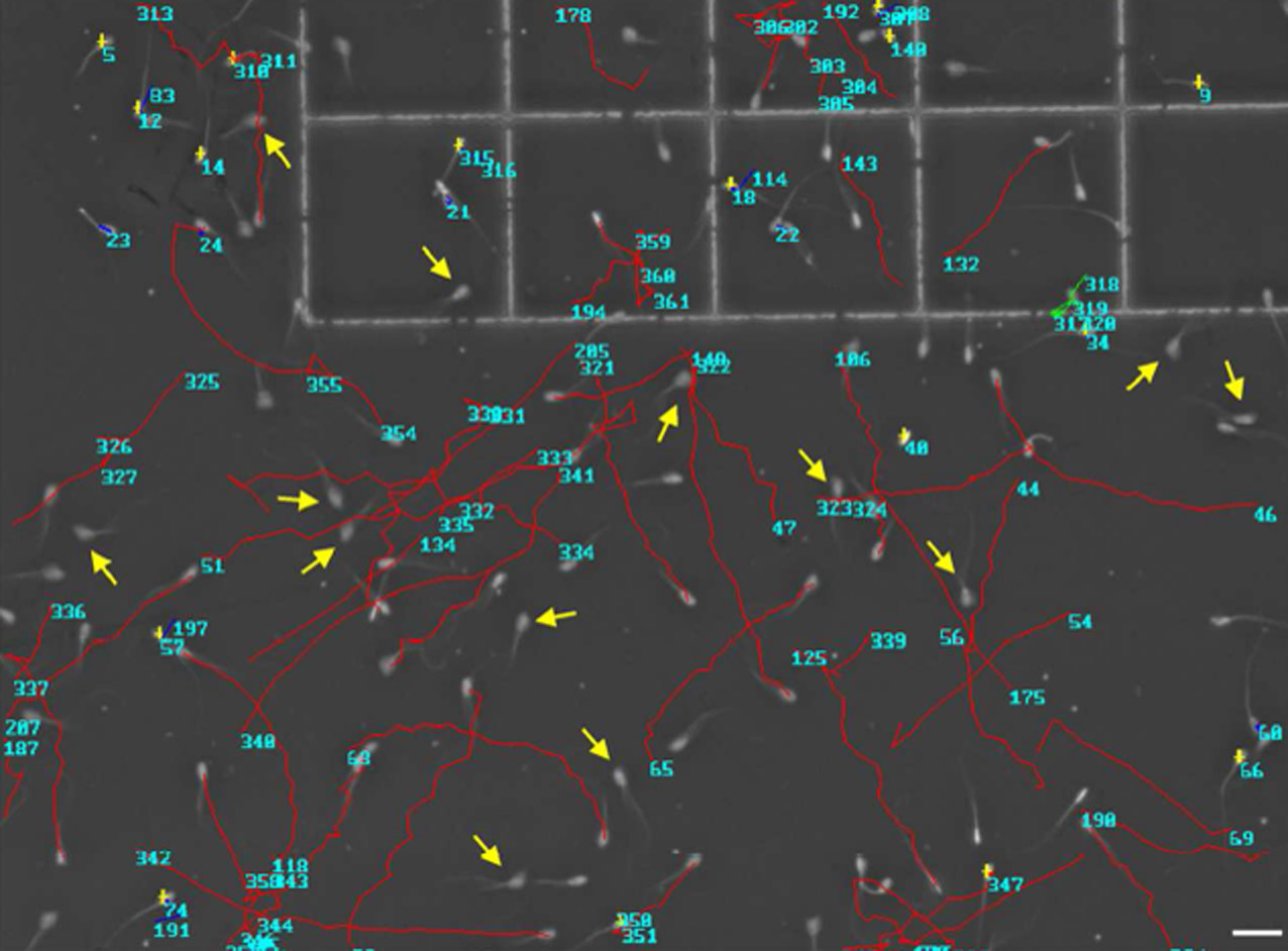 Captura de la pantalla del software en la que se puede apreciar la trayectoria de los espermas.