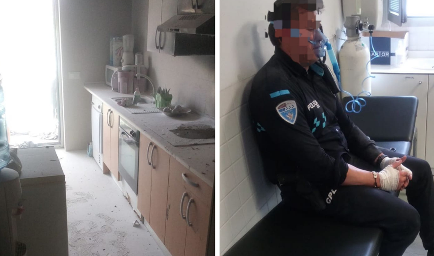 A la izquierda, el estado de la cocina donde se produjo el incendio; a la derecha, uno de los policías locales que sufrió quemaduras en las manos.