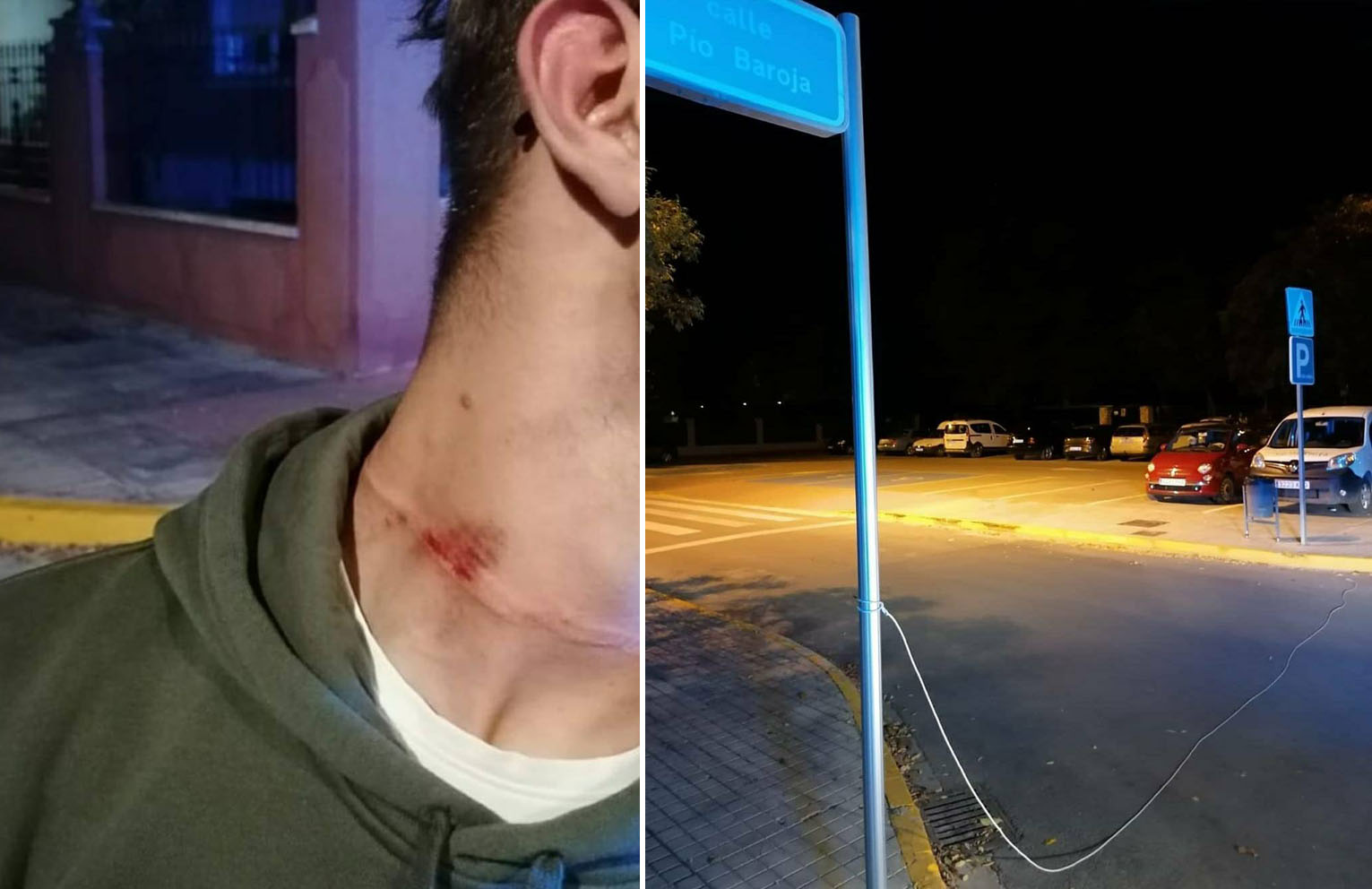 Un joven resultó herido con la cuerda que habían colocado en una calle de Almansa.