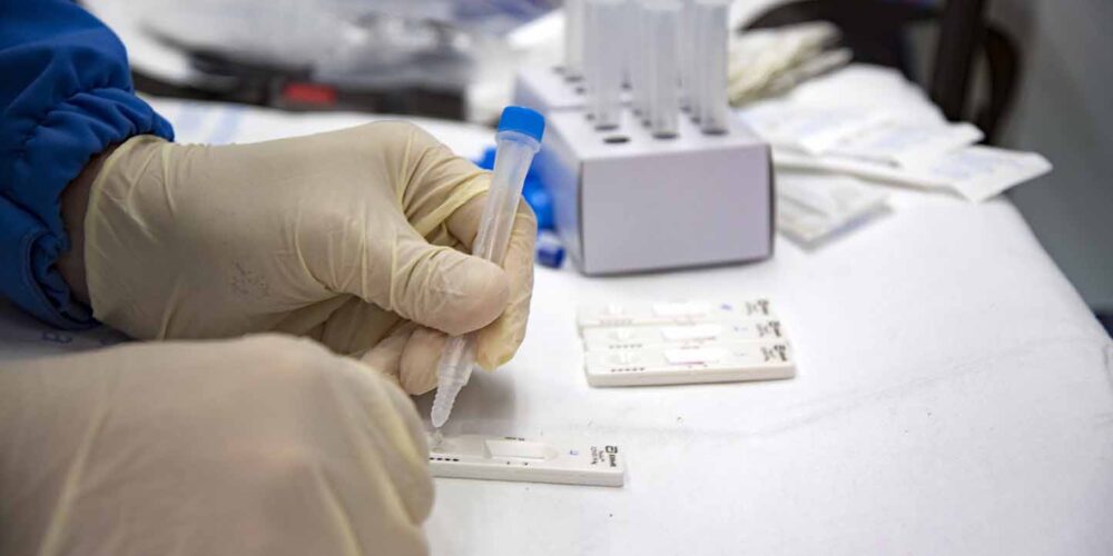 Test de antígenos en CLM, donde la variante británica sigue siendo la más frecuente