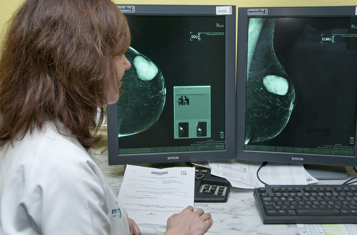 Imagen de archivo de un mamógrafo.
