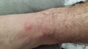Vecinos De Santa Barbara denuncian plaga en la piscina de Santa Barbara/Foto: Redes sociales del presidente de la AAVV Alcántara