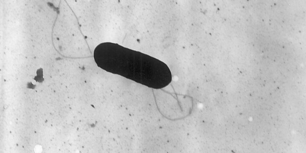 Listeria monocytogenes.