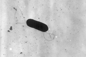 Listeria monocytogenes.