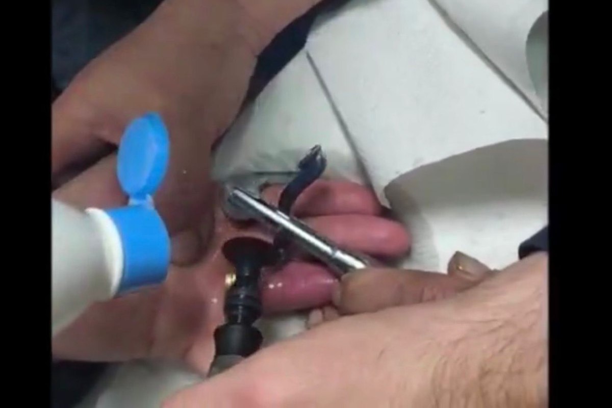 Los bomberos actuando sobre los anillos de la mujer