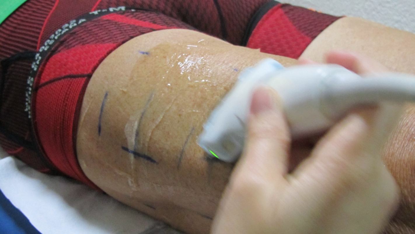 Uno de los estudios a los que se sometió Juan López. Foto cedida por Fissac. Autores: Martina Sáenz Garrido y Ainize Urdiales González.