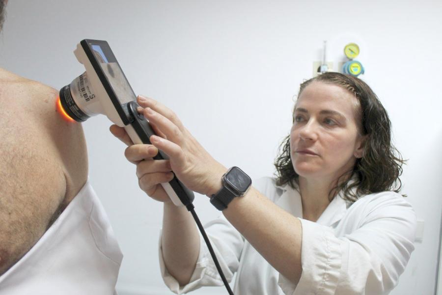 El Hospital de Ciudad Real estrena un sistema que detecta cambios sospechosos en los lunares para prevenir el melanoma